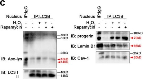 Fig.6.C showing Western Blotting from the publication: Nucleophagic Degradation of Progerin Ameliorates Defenestration in Liver Sinusoidal Endothelium Due to SIRT1-Mediated Deacetylation of Nuclear LC3.