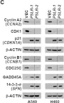 Fig.6.C showing Western Blotting from the publication: Systematic lncRNA mapping to genome-wide co-essential modules uncovers cancer dependency on uncharacterized lncRNAs.