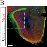 Fig.1.B showing Immunohistochemistry-immunofluorescence in a Mus musculus (House mouse) sample from the publication: Laminar organization of the anterior olfactory nucleus-the interplay between neurogenesis timing and neuroblast migration.
