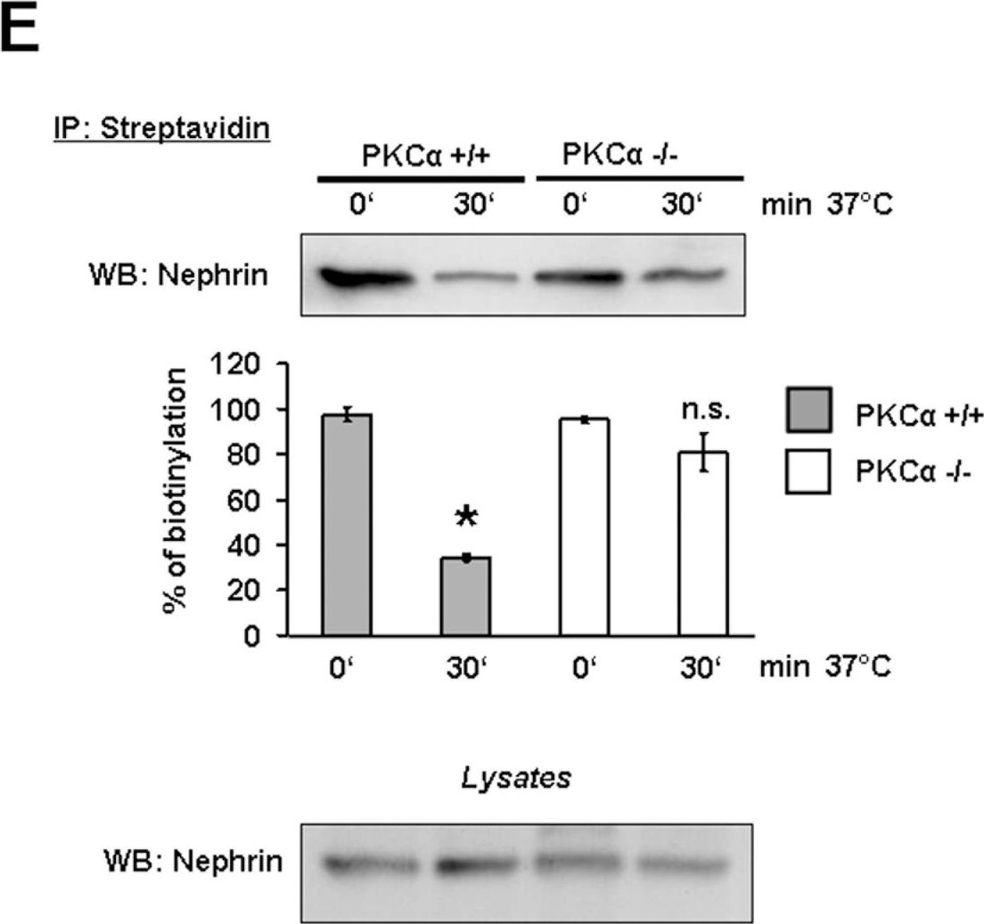 Podocytic PKC-alpha is regulated in murine and human diabetes and mediates nephrin endocytosis.