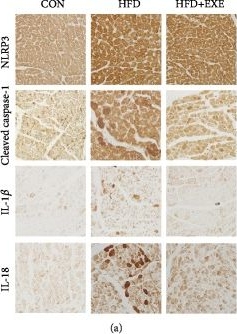 Fig.4.A showing Enzyme-linked immunosorbent assay from the publication: Exendin-4 Protects against Hyperglycemia-Induced Cardiomyocyte Pyroptosis via the AMPK-TXNIP Pathway.