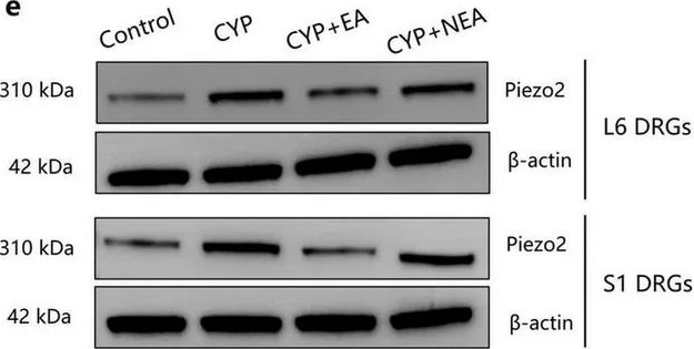 Fig.5.E showing Western Blotting in a Rattus norvegicus (Rat) sample from the publication: Piezo2 in sensory neurons contributes to inflammation-induced bladder overactivity and is associated with the effects of electroacupuncture.