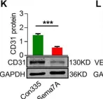 Fig.1.K showing Western Blotting from the publication: Semaphorin 7A promotes endothelial to mesenchymal transition through ATF3 mediated TGF-β2/Smad signaling.