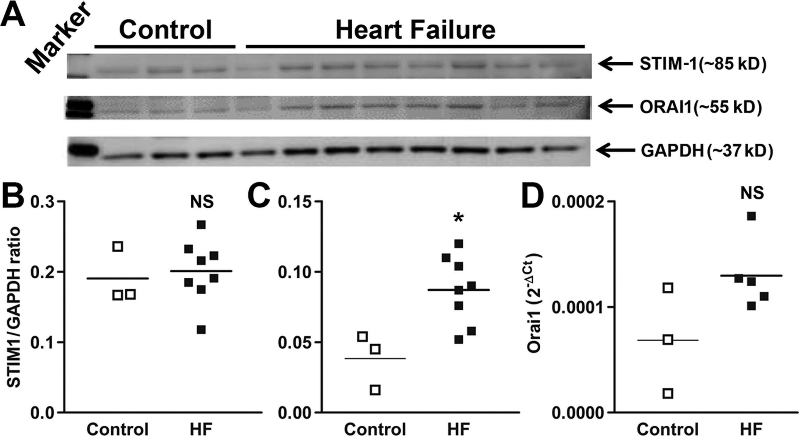 Fig.5.A showing Western Blotting from the publication: Enhanced store-operated Ca2+ influx and ORAI1 expression in ventricular fibroblasts from human failing heart.