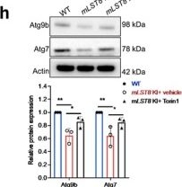 Fig.5.H showing Western Blotting in a Homo sapiens (Human) sample from the publication: Activated mTOR Signaling in the RPE Drives EMT, Autophagy, and Metabolic Disruption, Resulting in AMD-Like Pathology in Mice.