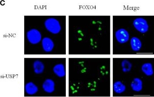 Fig.4.C showing Immunocytochemistry-immunofluorescence from the publication: Proteome Analysis of USP7 Substrates Revealed Its Role in Melanoma Through PI3K/Akt/FOXO and AMPK Pathways.