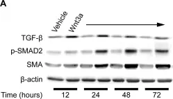 Fig.6.A showing Western Blotting from the publication: Wnt3a induces myofibroblast differentiation by upregulating TGF-β signaling through SMAD2 in a β-catenin-dependent manner.