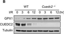 Fig.4.B showing Western Blotting in a Mus musculus (House mouse) sample from the publication: CUEDC2 modulates cardiomyocyte oxidative capacity by regulating GPX1 stability.