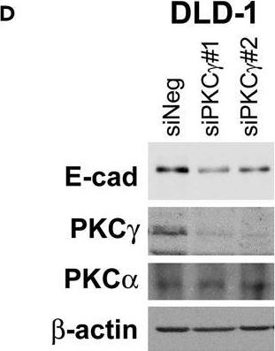 Fig.3.D showing Western Blotting in a Homo sapiens (Human) sample from the publication: Downregulation of protein kinase C gamma reduces epithelial property and enhances malignant phenotypes in colorectal cancer cells.