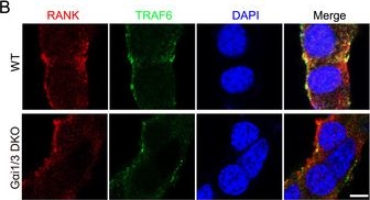Fig.6.B showing Immunocytochemistry-immunofluorescence from the publication: Gαi1/3 Is a Novel Regulatory Target for RANKL Signal Transduction and Osteoporosis.