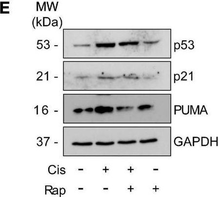 Fig.4.E showing Western Blotting from the publication: Alleviation of cisplatin-induced neuropathic pain, neuronal apoptosis, and systemic inflammation in mice by rapamycin.