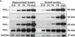 Fig.6.A showing Western Blotting from the publication: CD40 is a major regulator of dendrite growth from developing excitatory and inhibitory neurons.