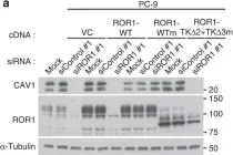 Fig.6.A showing Western Blotting in a Homo sapiens (Human) sample from the publication: ROR1 sustains caveolae and survival signalling as a scaffold of cavin-1 and caveolin-1.