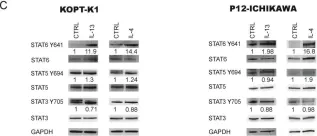 Fig.2.C showing Western Blotting from the publication: Ruxolitinib as a Novel Therapeutic Option for Poor Prognosis T-LBL Pediatric Patients.