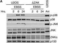 Fig.1.A showing Western Blotting from the publication: Ribosome stalling is a signal for metabolic regulation by the ribotoxic stress response.