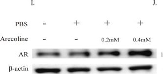 Fig.5.L showing Western Blotting from the publication: Exploring the molecular link between arecoline exposure and prostate cancer-related alterations: integrative evidence from network toxicology, single-cell transcriptomics, molecular simulation, and experimental validation.