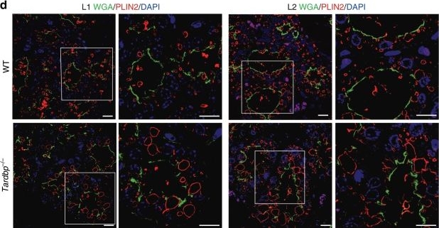TDP-43 facilitates milk lipid secretion by post-transcriptional regulation of Btn1a1 and Xdh.