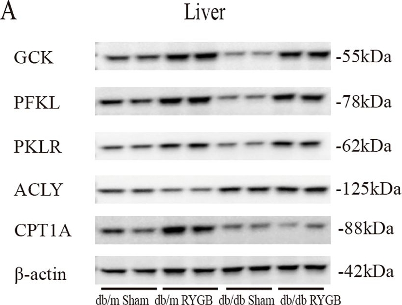 Fig.4.A showing Western Blotting in a Mus musculus (House mouse) sample from the publication: Leptin receptor deficiency impedes metabolic surgery related-weight loss through inhibition of energy expenditure in db/db mice.