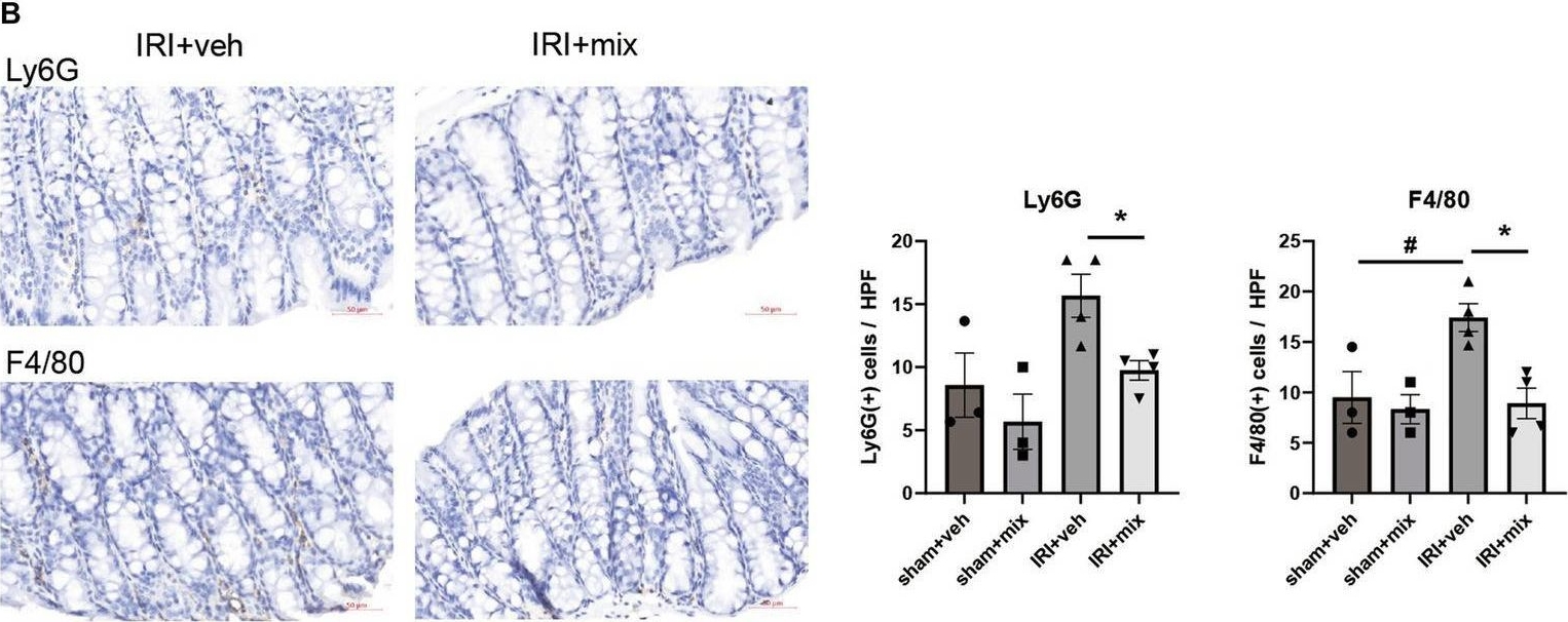 Fig.5.B showing Immunohistochemistry in a Mus musculus (House mouse) sample from the publication: Altered gut microbiome plays an important role in AKI to CKD transition in aged mice.