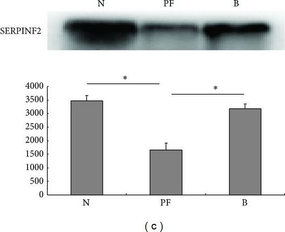 Fig.2.C showing Western Blotting in a Homo sapiens (Human) sample from the publication: Identification of differentially expressed serum proteins in infectious purpura fulminans.