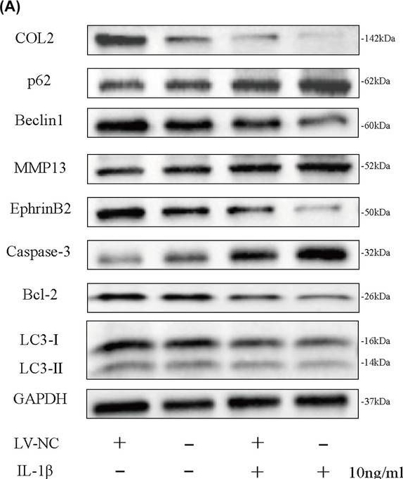 Fig.5.A showing Western Blotting from the publication: EphrinB2-mediated chondrocyte autophagy induces post-traumatic arthritis via rupture of cartilage homeostasis.