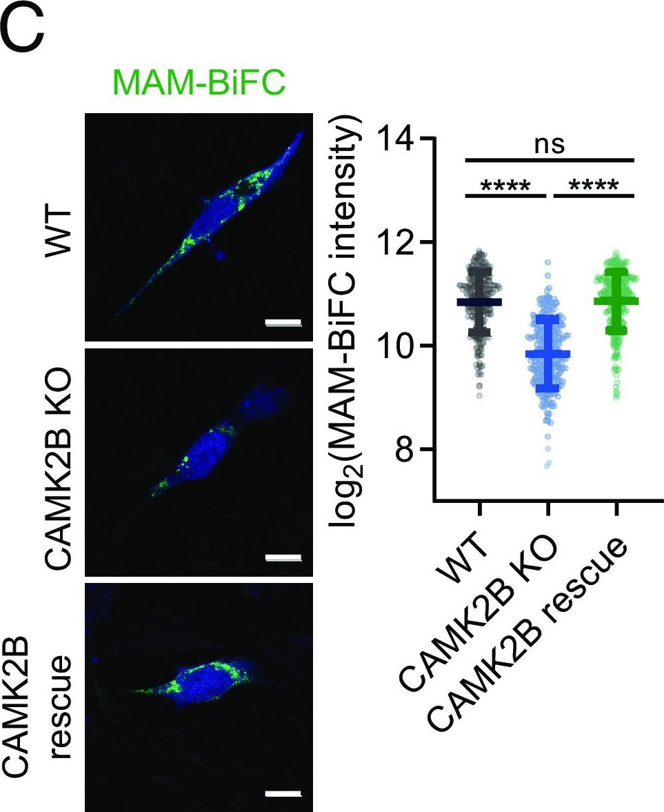 Fig.2.C showing Immunocytochemistry-immunofluorescence from the publication: Genome-wide kinase-MAM interactome screening reveals the role of CK2A1 in MAM Ca2+ dynamics linked to DEE66.
