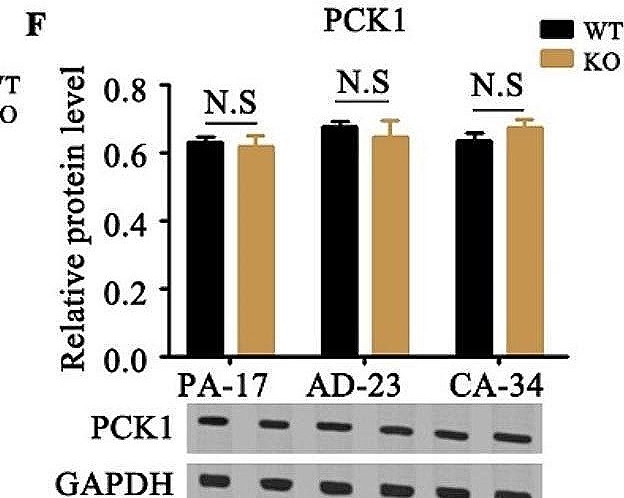 Fig.5.F showing Western Blotting from the publication: The selective sponging of miRNAs by OIP5-AS1 regulates metabolic reprogramming of pyruvate in adenoma-carcinoma transition of human colorectal cancer.