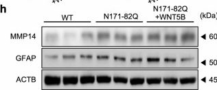 Fig.5.H showing Western Blotting from the publication: Astrocytic noncanonical WNT5B signaling modulates extracellular matrix remodeling and neuropathology in Huntington's disease.