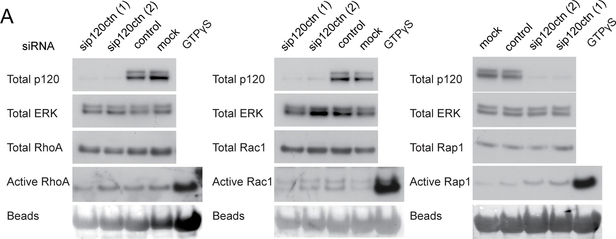 Fig.4.A showing Western Blotting from the publication: p120ctn and P-cadherin but not E-cadherin regulate cell motility and invasion of DU145 prostate cancer cells.