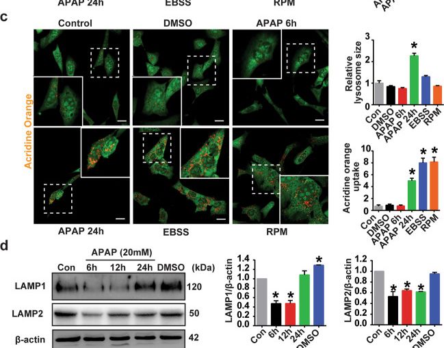 Fig.5.C showing Immunocytochemistry-immunofluorescence from the publication: Autophagy impairment as a key feature for acetaminophen-induced ototoxicity.