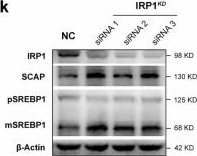 Fig.6.K showing Western Blotting from the publication: Iron overload reprogramming lipid metabolism through the IRP1-SCAP axis in fibroblast-like synoviocytes aggravates bone destruction in rheumatoid arthritis.