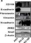 Fig.6.B showing Western Blotting from the publication: CD109 acts as a gatekeeper of the epithelial trait by suppressing epithelial to mesenchymal transition in squamous cell carcinoma cells in vitro.