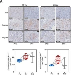 Fig.4.A showing Immunohistochemistry in a Homo sapiens (Human) sample from the publication: Beyond CD30: Dual-Targeting of Malignant and Regulatory T Cells by Brentuximab Vedotin Remodels the Lymphoma Microenvironment and Overcomes Resistance via BCL2 Inhibition in Mycosis Fungoides.