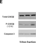 Fig.3.E showing Western Blotting in a Drosophila melanogaster (Fruit fly) sample from the publication: Tau pathogenesis is promoted by Aβ1-42 but not Aβ1-40.
