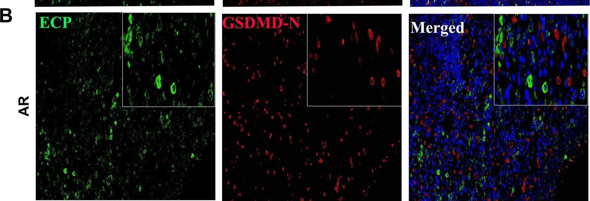 Fig.1.B showing Immunohistochemistry-immunofluorescence from the publication: Allergen-induced CD11c + dendritic cell pyroptosis aggravates allergic rhinitis.