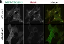 Fig.2.B showing Immunocytochemistry-immunofluorescence from the publication: TBC1D12 is a novel Rab11-binding protein that modulates neurite outgrowth of PC12 cells.