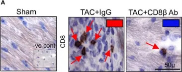 Fig.1.A showing Immunohistochemistry from the publication: Crosstalk between cytotoxic CD8+ T cells and stressed cardiomyocytes triggers development of interstitial cardiac fibrosis in hypertensive mouse hearts.
