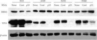 Fig.3.A showing Western Blotting in a Homo sapiens (Human) sample from the publication: Modulation of the ribonucleotide reductase-antimetabolite drug interaction in cancer cell lines.