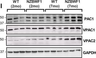 Fig.2.I showing Western Blotting in a Mus musculus (House mouse) sample from the publication: Altered Hippocampal and Striatal Expression of Endothelial Markers and VIP/PACAP Neuropeptides in a Mouse Model of Systemic Lupus Erythematosus.