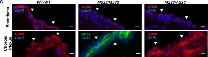 Fig.4.C showing Immunohistochemistry-immunofluorescence from the publication: Deletions in CWH43 cause idiopathic normal pressure hydrocephalus.