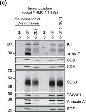 Fig.8.C showing Western Blotting in a Homo sapiens (Human) sample from the publication: Selective immunocapture reveals neoplastic human mast cells secrete distinct microvesicle- and exosome-like populations of KIT-containing extracellular vesicles.