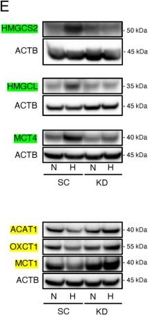 Fig.3.E showing Western Blotting from the publication: Putative Role of Fatty Acid Metabolic Therapy Using Ketogenic Diet and HIF-1α Inhibition in Hepatocellular Carcinoma: Evidence from an In Vitro Study.