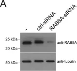 Fig.5.A showing Western Blotting in a Homo sapiens (Human) sample from the publication: The G2019S variant of leucine-rich repeat kinase 2 (LRRK2) alters endolysosomal trafficking by impairing the function of the GTPase RAB8A.