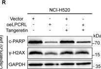 Fig.5.R showing Western Blotting from the publication: A novel antisense lncRNA, LPCRL, functions as a molecular scaffold for the USP15/MIB1 complex to promote primary cisplatin resistance and tumor progression in lung squamous cell carcinoma.
