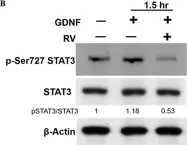 Fig.3.B showing Western Blotting from the publication: RET Regulates Human Medullary Thyroid Cancer Cell Proliferation through CDK5 and STAT3 Activation.