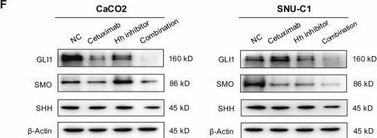 Fig.14.F showing Western Blotting in a Homo sapiens (Human) sample from the publication: circ-EGFR is a predictor of response to Cetuximab and a potential target in colorectal cancer.