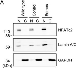 Fig.7.A showing Western Blotting in a Mus musculus (House mouse) sample from the publication: Kujiol A Inhibits Interferon-γ and Interleukin-2 Expression and the NFATc2 Interaction with Their Promoters in T Cells.
