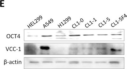 Fig.1.E showing Western Blotting from the publication: OCT4 promotes lung cancer progression through upregulation of VEGF-correlated chemokine-1.