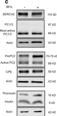 Fig.5.C showing Western Blotting from the publication: SERCA2 regulates proinsulin processing and processing enzyme maturation in pancreatic beta cells.