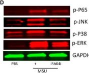 Phospho-SAPK/JNK (Thr183/Tyr185) Antibody | Cell Signaling Technology
